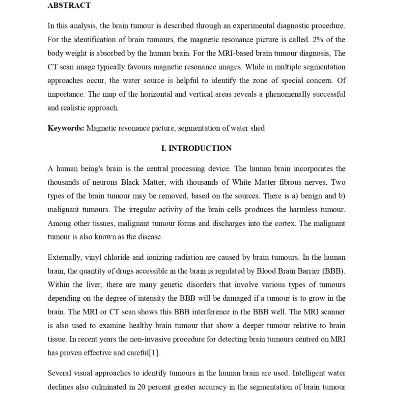 BRAIN TUMOUR EDGE DETECTION BY SEGMENTATION TECHNIQUE